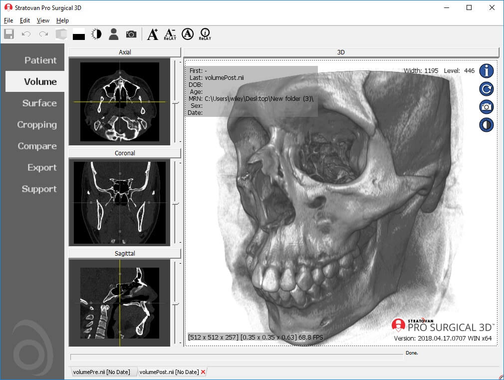 ProSurgical3D - Presented by PostDICOM